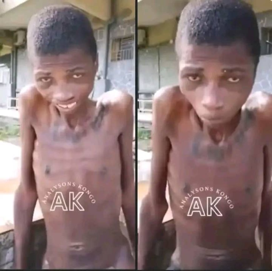 Kinshasa : Un conducteur de tricycle, victime d'abus de pouvoir, est méconnaissable après des mois de détention